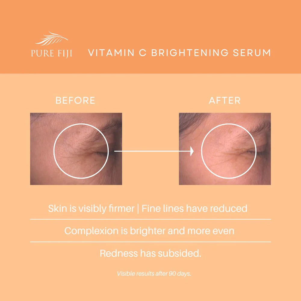 KAKADU SUPER VITAMIN C BRIGHTENING SERUM WITH HYALURONATE + BAKUCHIOL